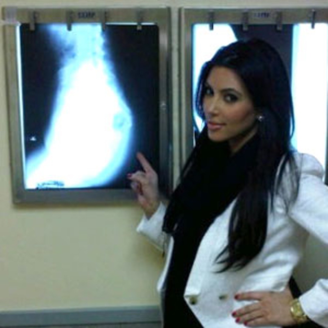 Kim Kardashian X-Rays Her Butt: It's Real and It's Spectacular - E! Online